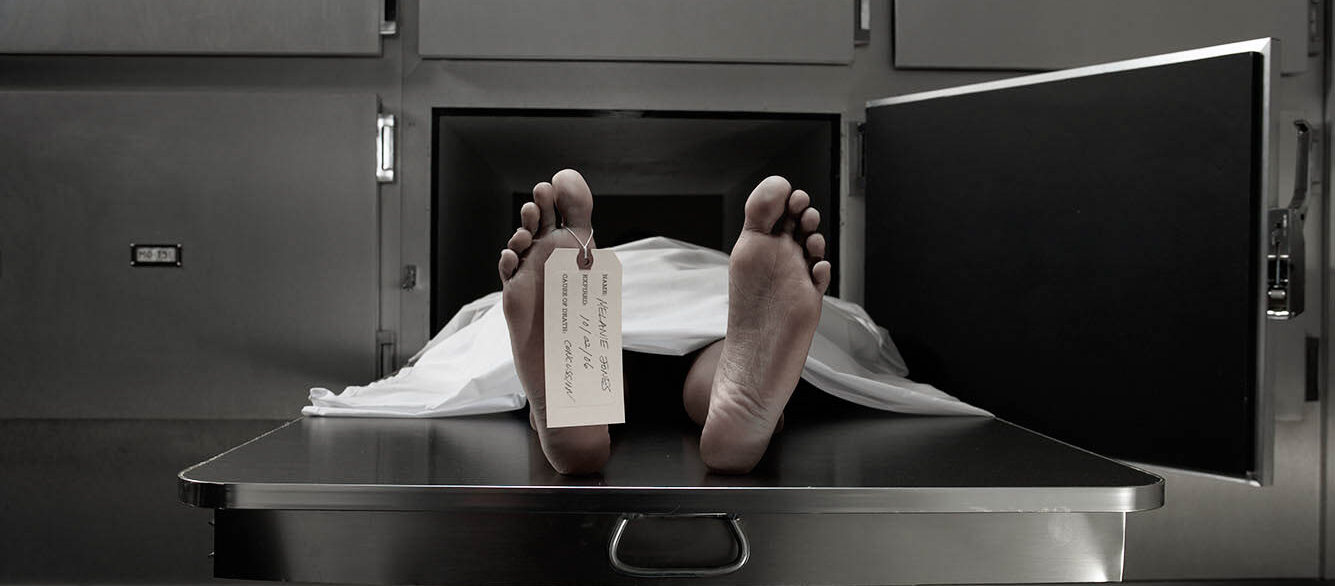Cadaver on autopsy table, label tied to toe Cadaver on autopsy table, label tied to toe